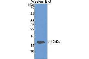Detection of Recombinant VCL, Human using Anti-Vinculin (VCL) Polyclonal Antibody (Vinculin anticorps  (AA 1020-1134))
