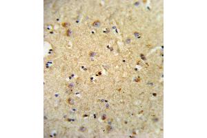 Formalin-fixed and paraffin-embedded human brain tissue reacted with OLR1 Antibody (Center), which was peroxidase-conjugated to the secondary antibody, followed by DAB staining. (OLR1 anticorps  (AA 64-92))