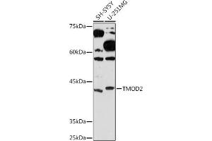 Western blot analysis of extracts of various cell lines, using TMOD2 Rabbit mAb (ABIN7271011) at 1:1000 dilution.