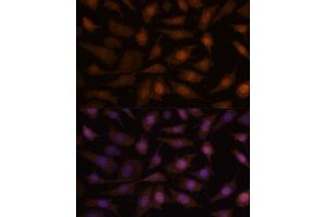 anti-Eukaryotic Translation Elongation Factor 1 epsilon 1 (EEF1E1) (AA 1-100) antibody