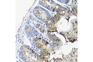 Immunohistochemistry of paraffin-embedded mouse jejunum using  antibody (ABIN6127437, ABIN6136922, ABIN6136923 and ABIN6217829) at dilution of 1:50 (40x lens). (Annexin A13 anticorps  (AA 1-316))