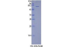 SDS-PAGE analysis of Human TERF1 Protein. (TRF1 Protéine)