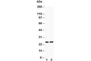 Western blot testing of Claudin 2 antibody and Lane 1:  rat kidney (Claudin 2 anticorps  (AA 38-230))