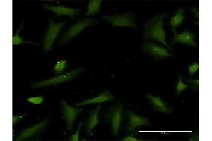 Immunofluorescence of monoclonal antibody to HTN3 on HeLa cell. (HTN3 anticorps  (AA 1-51))