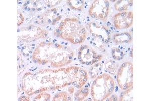 Used in DAB staining on fromalin fixed paraffin- embedded kidney tissue (MAPK13 anticorps  (AA 1-365))