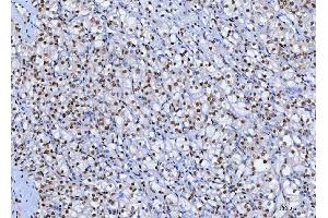 IHC analysis of SP1 using anti-SP1 antibody (ABIN7601559).