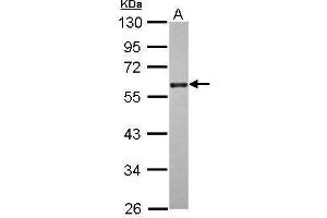 WB Image Sample (30 ug of whole cell lysate) A: A431 10% SDS PAGE antibody diluted at 1:2000 (CDC25C anticorps)