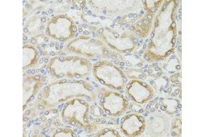 Immunohistochemistry of paraffin-embedded Rat kidney using MT-ND5 Polyclonal Antibody at dilution of 1:100 (40x lens). (MT-ND5 anticorps)