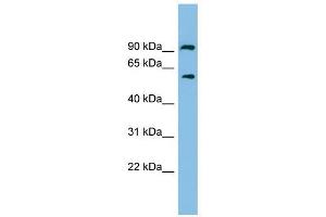 ALDH7A1 antibody used at 1 ug/ml to detect target protein. (ALDH7A1 anticorps  (N-Term))