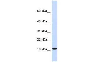 WB Suggested Anti-HMGN1 Antibody Titration:  0. (HMGN1 anticorps  (Middle Region))