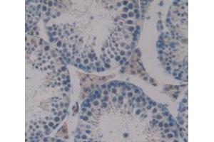 IHC-P analysis of Mouse Tissue, with DAB staining. (Dermatopontin anticorps  (AA 29-197))