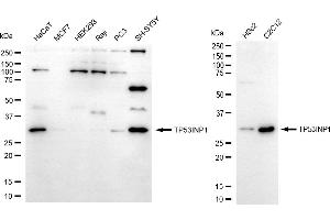 Western blotting analysis using TP53INP1 antibody (ABIN7800692).