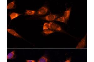 Immunofluorescence analysis of NIH-3T3 cells using TXNDC12 Polyclonal Antibody at dilution of 1:100 (40x lens). (TXNDC12 anticorps)