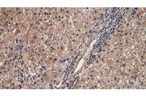 Detection of IFNg in Human Liver Tissue using Monoclonal Antibody to Interferon Gamma (IFNg) (Interferon gamma anticorps  (AA 24-166))