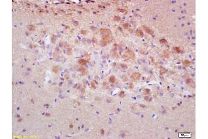 Formalin-fixed and paraffin embedded rat brain labeled with Rabbit Anti pro-caspase-3 Polyclonal Antibody, Unconjugated (ABIN747728) at 1:200 followed by conjugation to the secondary antibody and DAB staining (Caspase 3 anticorps  (AA 11-120))