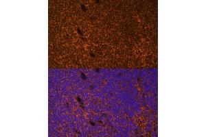 Immunofluorescence analysis of mouse embryos cells using PTCH1 antibody (ABIN1682368, ABIN1682367, ABIN3015342, ABIN3015343 and ABIN6213997) at dilution of 1:100. (Patched 1 anticorps  (AA 1214-1312))