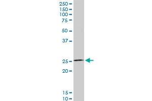 HOXC12 monoclonal antibody (M01), clone 1C6.