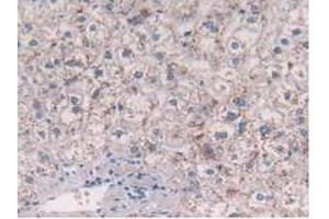 IHC-P analysis of Human Liver Tissue, with DAB staining. (CCL2 anticorps  (AA 24-99))