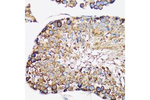 Immunohistochemistry of paraffin-embedded rat testis using IRAK4 antibody. (IRAK4 anticorps)