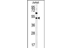 SSN1 Antibody (Center) (ABIN652058 and ABIN2840526) western blot analysis in Jurkat cell line lysates (35 μg/lane). (SAMSN1 anticorps  (AA 255-283))