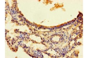 Immunohistochemistry of paraffin-embedded human lung tissue using ABIN7166376 at dilution of 1:100 (ZNF738 anticorps  (AA 1-137))