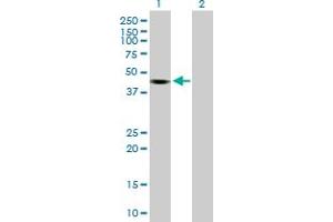 Western Blot analysis of KCTD18 expression in transfected 293T cell line by KCTD18 MaxPab polyclonal antibody. (KCTD18 anticorps  (AA 1-426))