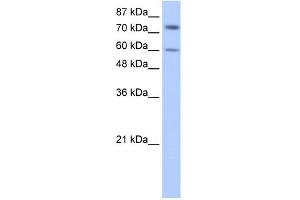 WB Suggested Anti-IGF2BP1 Antibody Titration:  0. (IGF2BP1 anticorps  (N-Term))