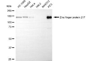 Western blotting analysis using zinc finger protein 217 antibody (ABIN7800894). (Recombinant ZNF217 anticorps)