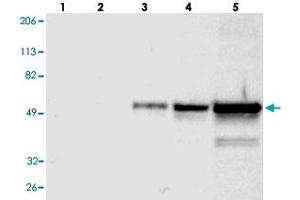 Western blot analysis of Lane 1: RT-4, Lane 2: U-251 MG, Lane 3: A-431, Lane 4: Liver, Lane 5: Tonsil with FGB polyclonal antibody . (Fibrinogen beta Chain anticorps)