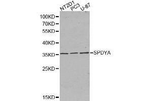 Western blot analysis of extracts of various cell lines, using SPDYA antibody. (SPDYA anticorps  (AA 1-313))