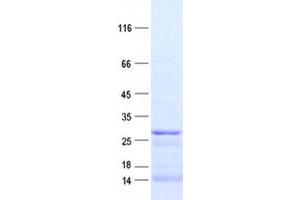 Validation with Western Blot