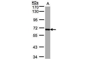 WB Image Sample(30 ug whole cell lysate) A:Raji , 7. (PLK1 anticorps)
