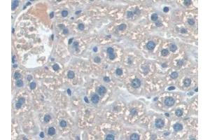 Detection of IL22Ra2 in Mouse Liver Tissue using Polyclonal Antibody to Interleukin 22 Receptor Alpha 2 (IL22Ra2) (IL22RA2 anticorps  (AA 31-223))