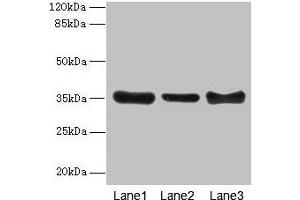 Western blot All lanes: ZNF625 antibody at 4 μg/mL Lane 1: Mouse brain tissue Lane 2: Mouse lung tissue Lane 3: Mouse ovarian tissue Secondary Goat polyclonal to rabbit IgG at 1/10000 dilution Predicted band size: 35, 43 kDa Observed band size: 35 kDa (ZNF625 anticorps  (AA 1-306))