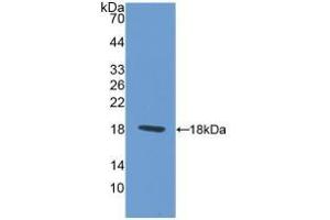 Detection of Recombinant PAX6, Rat using Polyclonal Antibody to Paired Box Gene 6 (PAX6) (PAX6 anticorps  (AA 1-130))