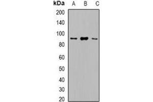 Western blot analysis of VPS35 expression in Hela (A), HepG2 (B), Raji (C) whole cell lysates. (VPS35 anticorps)