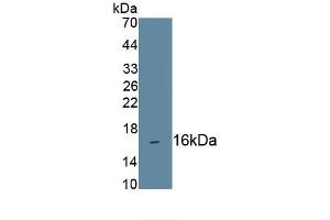 Detection of Recombinant CD160, Human using Monoclonal Antibody to Cluster Of Differentiation 160 (CD160) (CD160 anticorps  (AA 37-154))