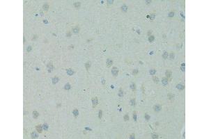 Immunohistochemistry of paraffin-embedded Rat brain using SMAD6 Polyclonal Antibody at dilution of 1:100 (40x lens). (SMAD6 anticorps)