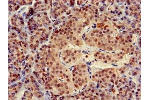 Immunohistochemistry of paraffin-embedded human pancreatic tissue using ABIN7173455 at dilution of 1:100 (TRIM5 anticorps  (AA 1-493))