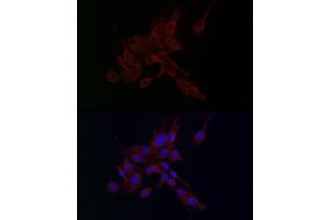 Immunofluorescence analysis of PC-12 cells using MMP2 antibody (ABIN6129301, ABIN6143911, ABIN6143913 and ABIN6221846) at dilution of 1:100. (MMP2 anticorps  (AA 40-280))