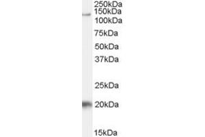 Western Blotting (WB) image for anti-HIV-1 Tat Specific Factor 1 (HTATSF1) (AA 19-33) antibody (ABIN297173) (HTATSF1 anticorps  (AA 19-33))
