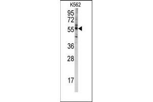 Image no. 1 for anti-Cytochrome P450, Family 4, Subfamily F, Polypeptide 8 (CYP4F8) (C-Term) antibody (ABIN360258) (CYP4F8 anticorps  (C-Term))