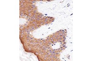 Immunohistochemical analysis of paraffin-embedded H.