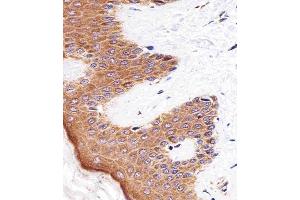 Immunohistochemical analysis of paraffin-embedded H. (BLMH anticorps  (AA 212-242))