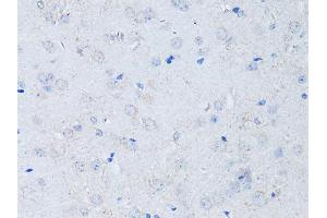 Immunohistochemistry of paraffin-embedded mouse brain using RYR2 Antibody (ABIN5970123) at dilution of 1/100 (40x lens). (RYR2 anticorps)