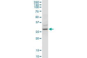 YWHAZ monoclonal antibody (M04), clone 1B3.