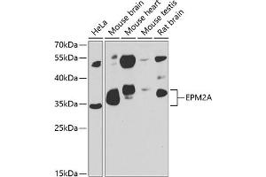 Western blot analysis of extracts of various cell lines, using EPM2A antibody (ABIN6131609, ABIN6140229, ABIN6140230 and ABIN6222778) at 1:1000 dilution.