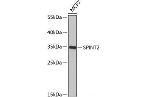 Western blot analysis of extracts of MCF-7 cells using SPINT2 Polyclonal Antibody at dilution of 1:1000. (SPINT2 anticorps)