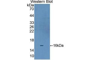Western blot analysis of the recombinant protein. (Fibronectin anticorps  (AA 2206-2337))