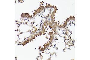 Immunohistochemistry of paraffin-embedded mouse lung using  Rabbit mAb (ABIN7265788) at dilution of 1:100 (40x lens). (ATG12 anticorps)